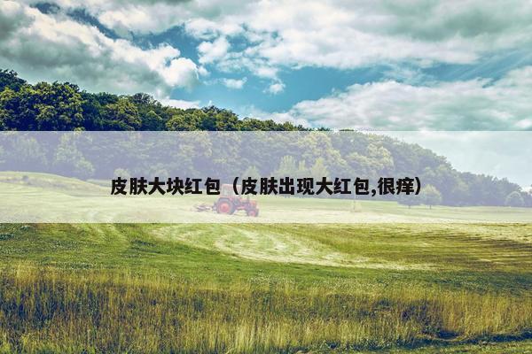 皮肤大块红包（皮肤出现大红包,很痒）